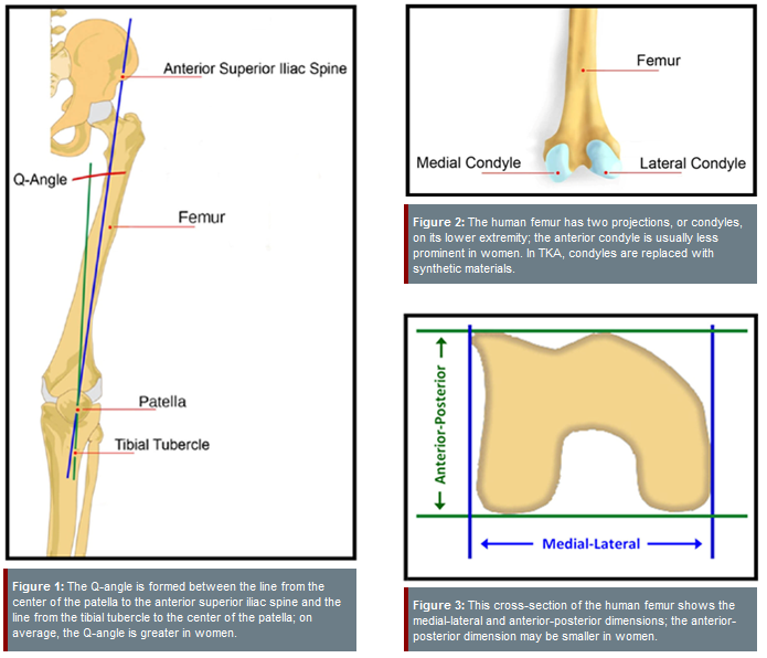 knee differences in women and men